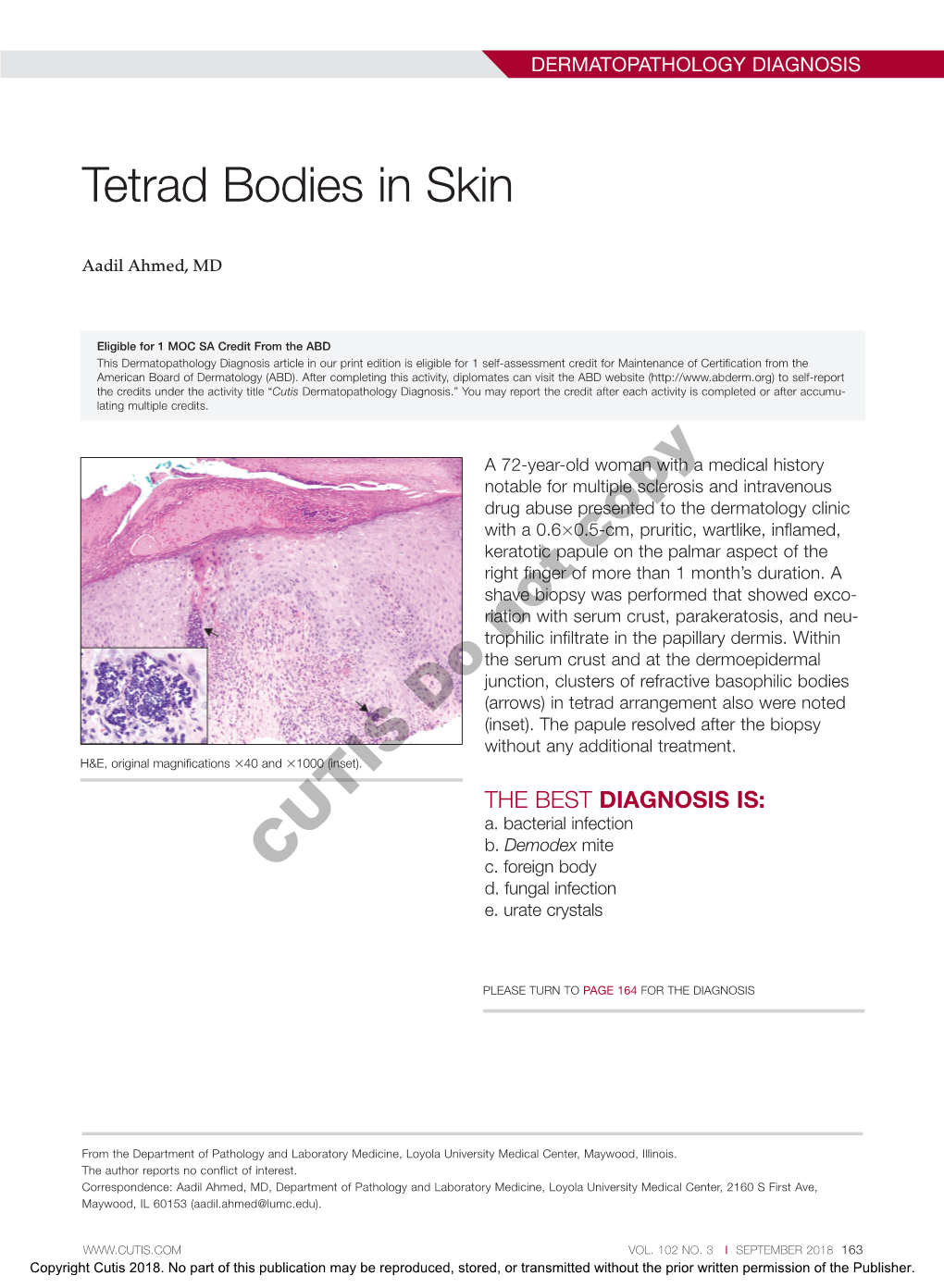 Tetrad Bodies in Skin