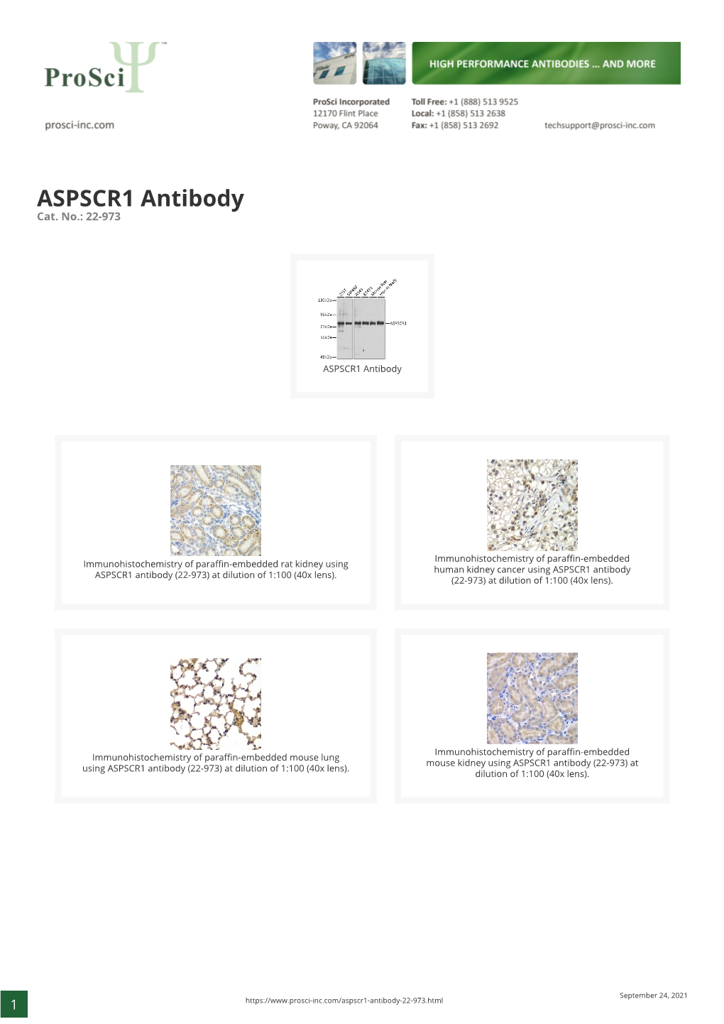 ASPSCR1 Antibody Cat