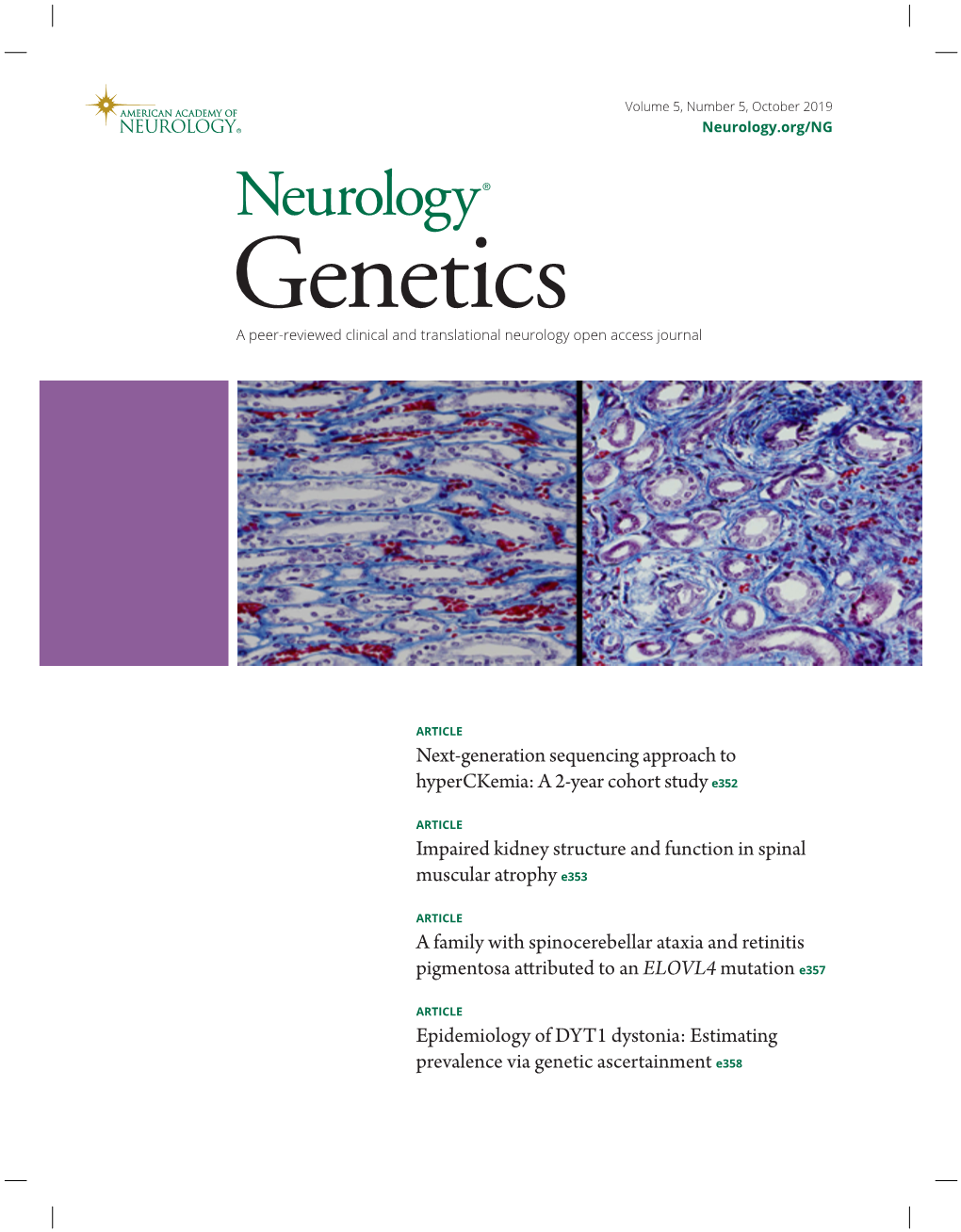 Next-Generation Sequencing Approach to Hyperckemia: a 2-Year Cohort Study E352