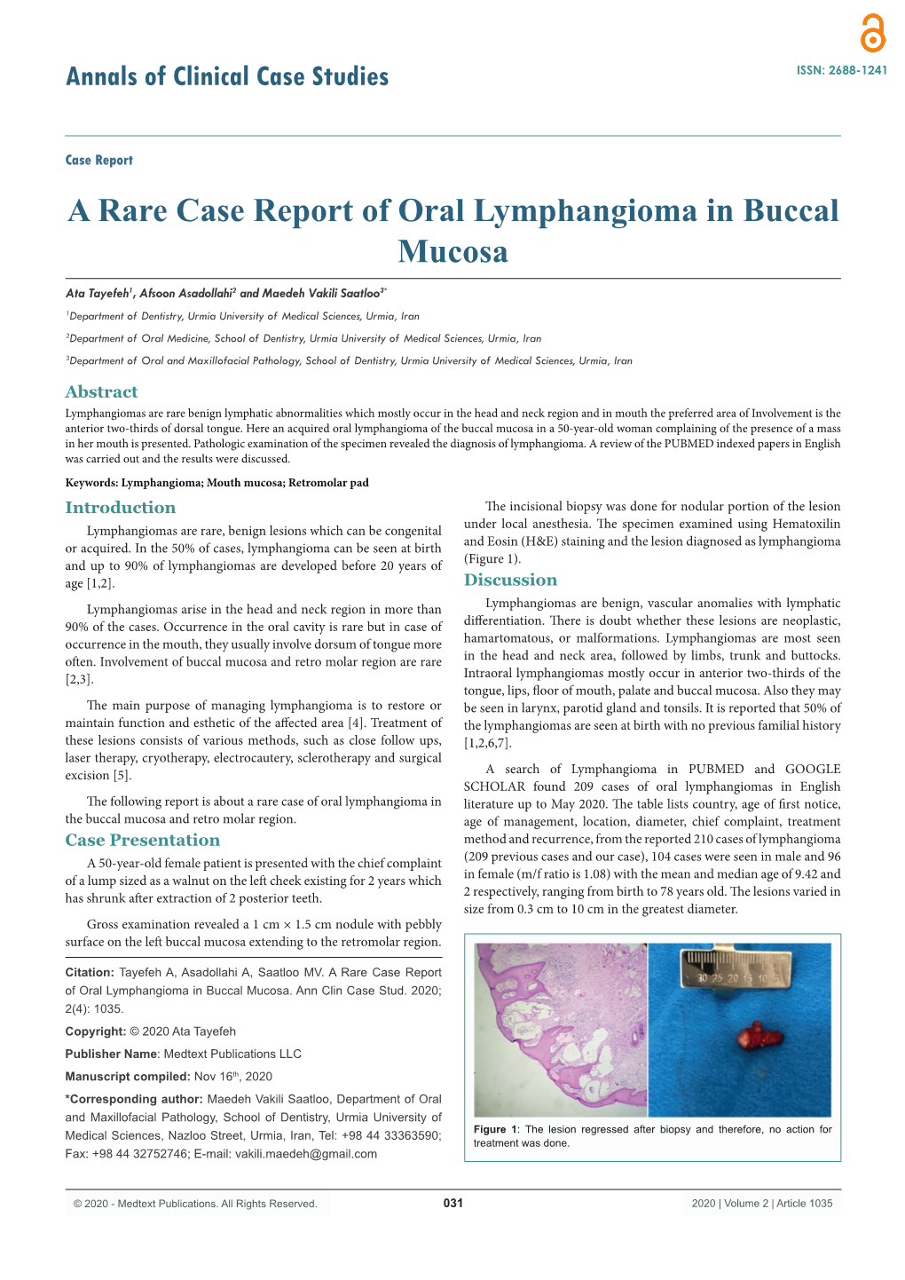 A Rare Case Report of Oral Lymphangioma in Buccal Mucosa