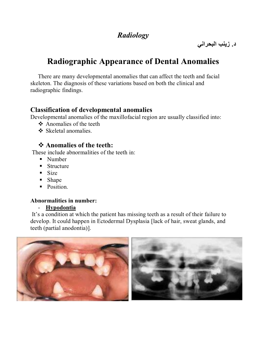 Anomalies of the Teeth  Skeletal Anomalies