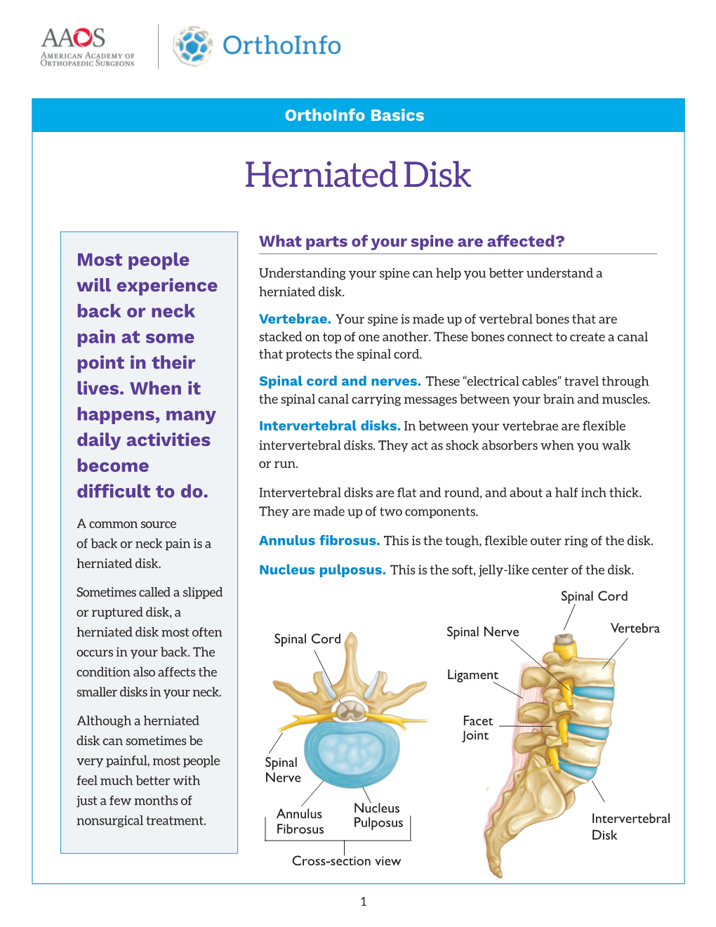 Herniated Disk