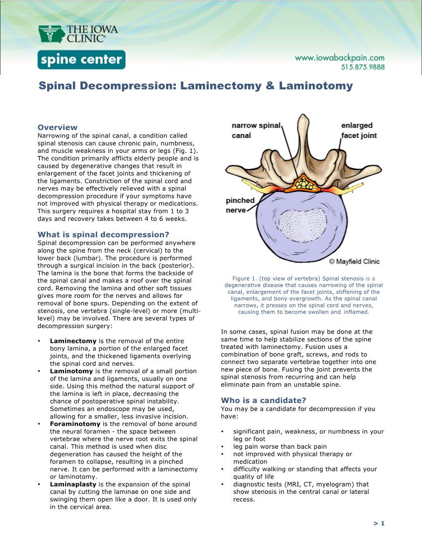 Spinal Decompression: Laminectomy & Laminotomy