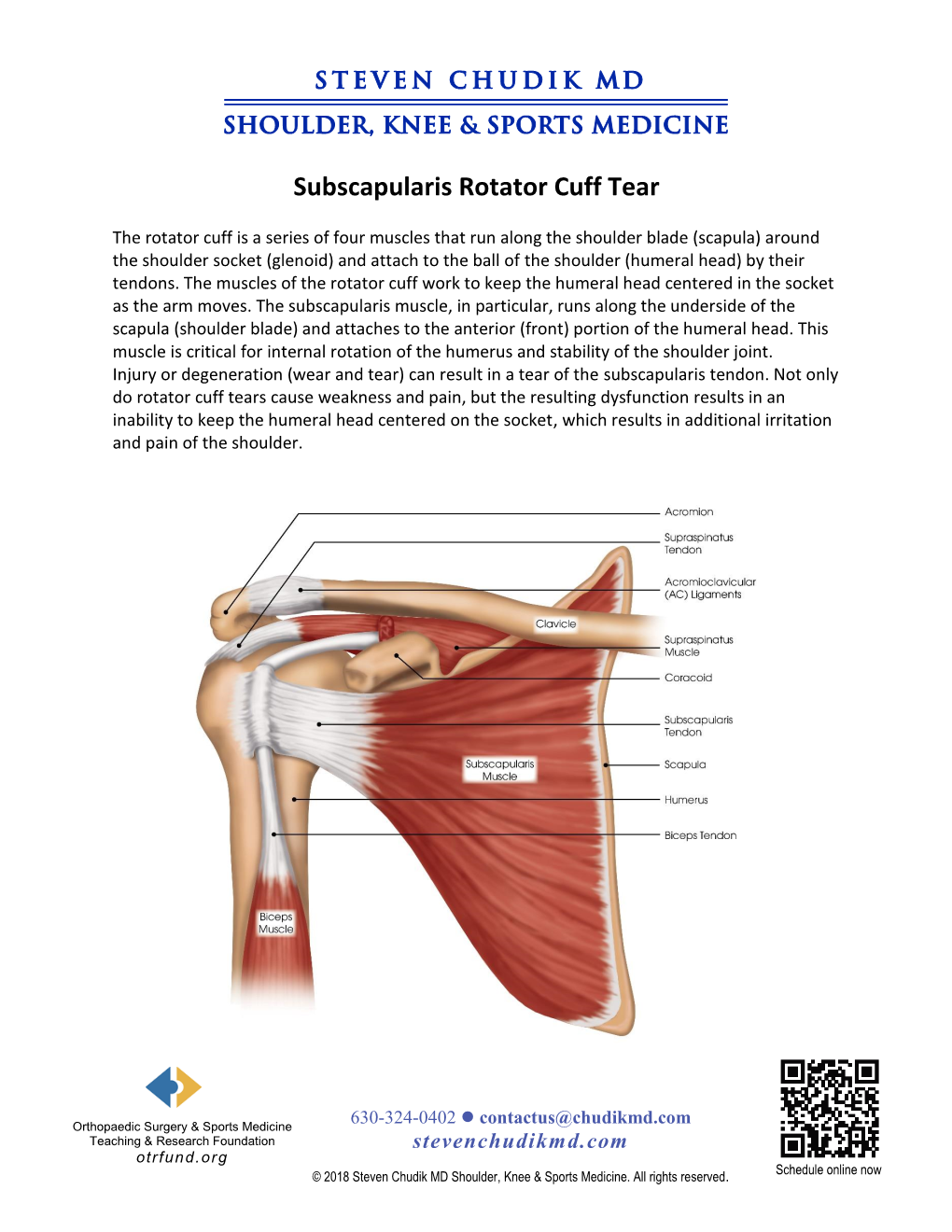 Subscapularis Rotator Cuff Tear - DocsLib