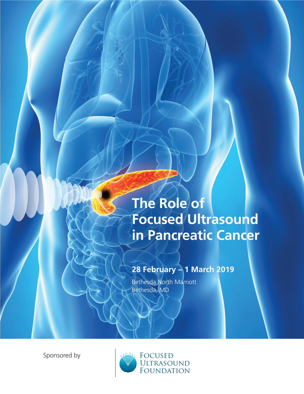 Focused Ultrasound and Pancreatic Cancer Workshop