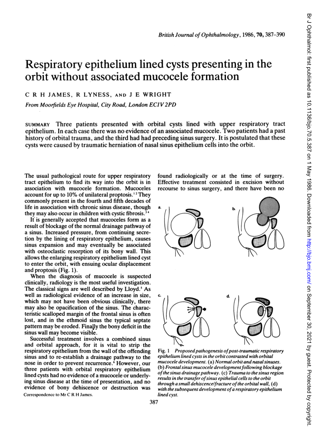 Respiratory Epithelium Lined Cysts Presenting in the Orbit Without Associated Mucocele Formation