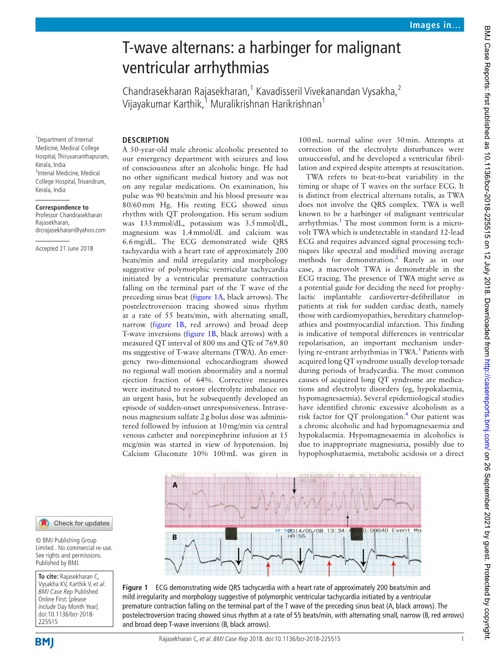 T-Wave Alternans: a Harbinger for Malignant Ventricular Arrhythmias