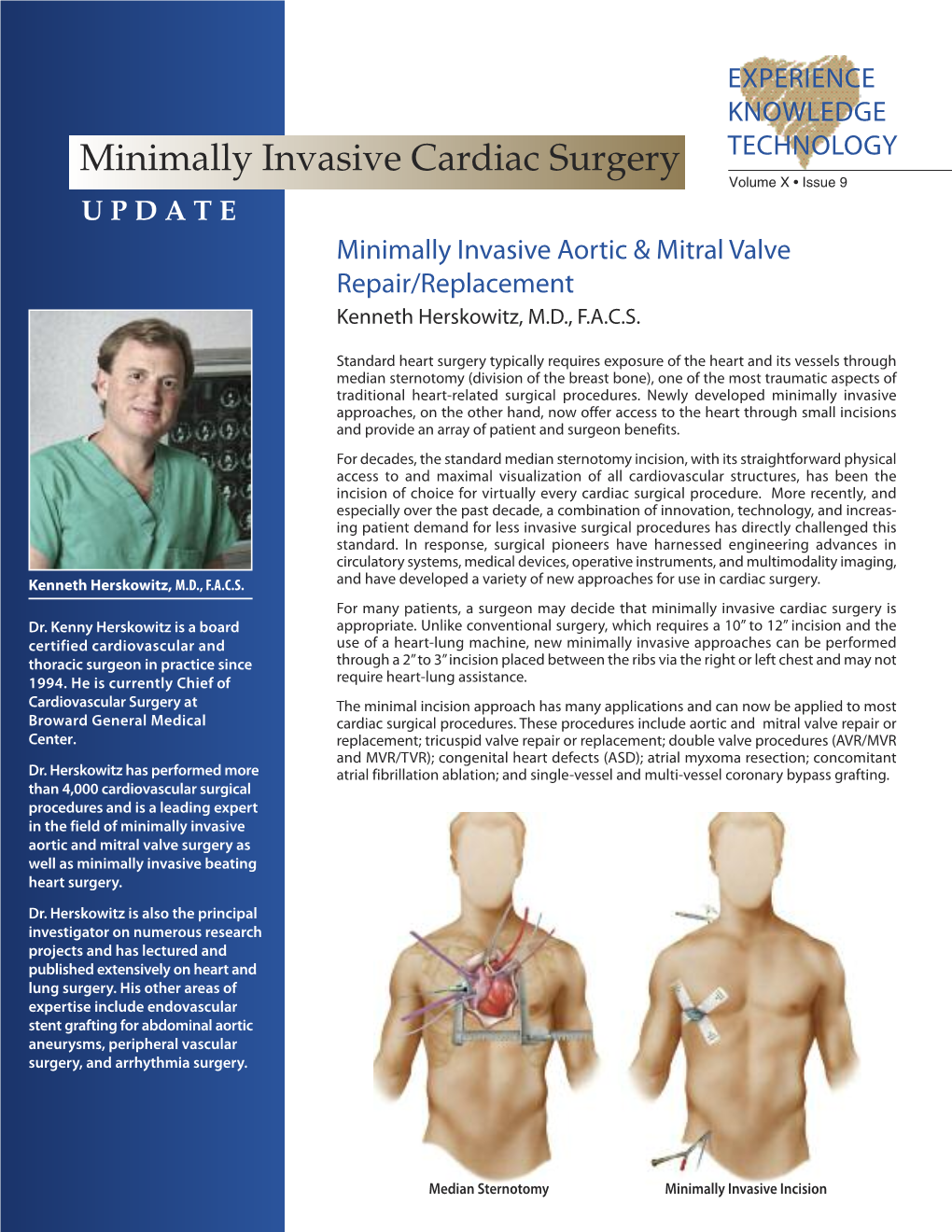 Minimally Invasive Cardiac Surgery