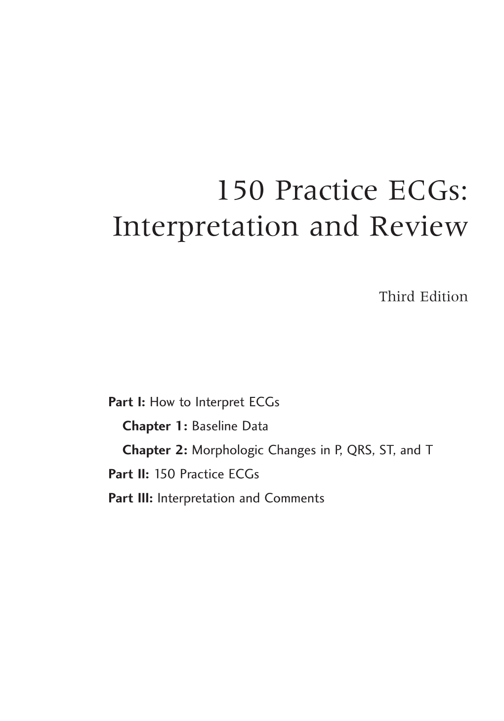 150 Practice Ecgs: Interpretation and Review