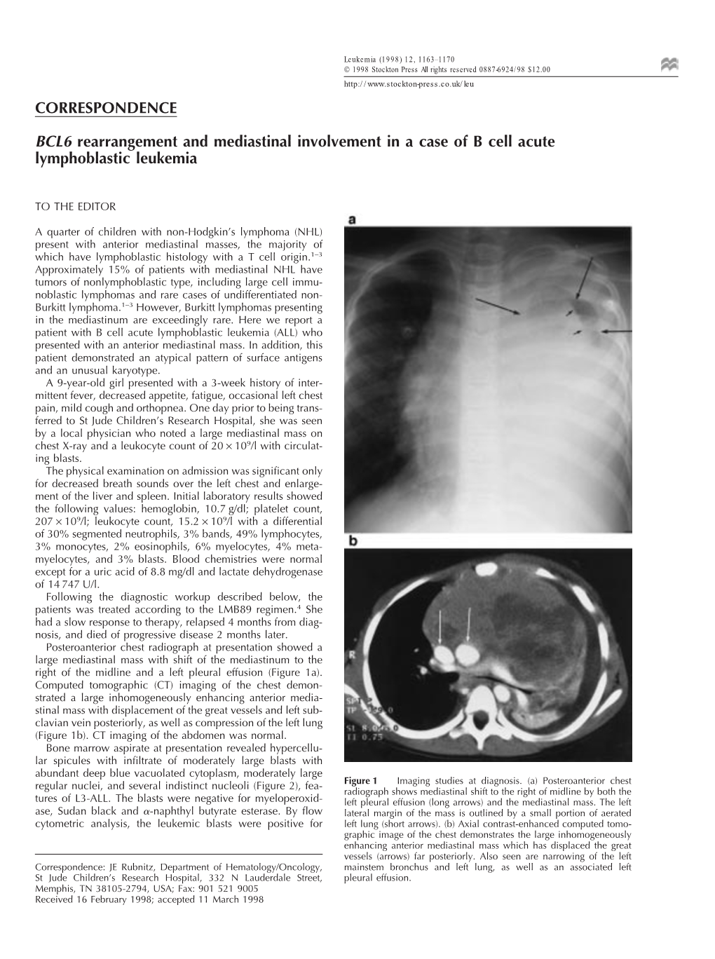 BCL6 Rearrangement and Mediastinal Involvement in a Case of B Cell Acute Lymphoblastic Leukemia