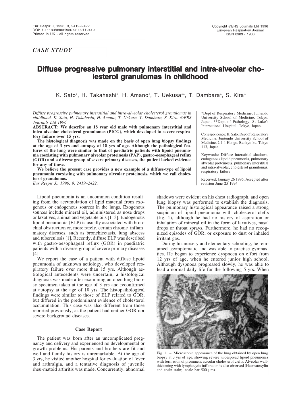 Diffuse Progressive Pulmonary Interstitial and Intra-Alveolar Cho- Lesterol Granulomas in Childhood