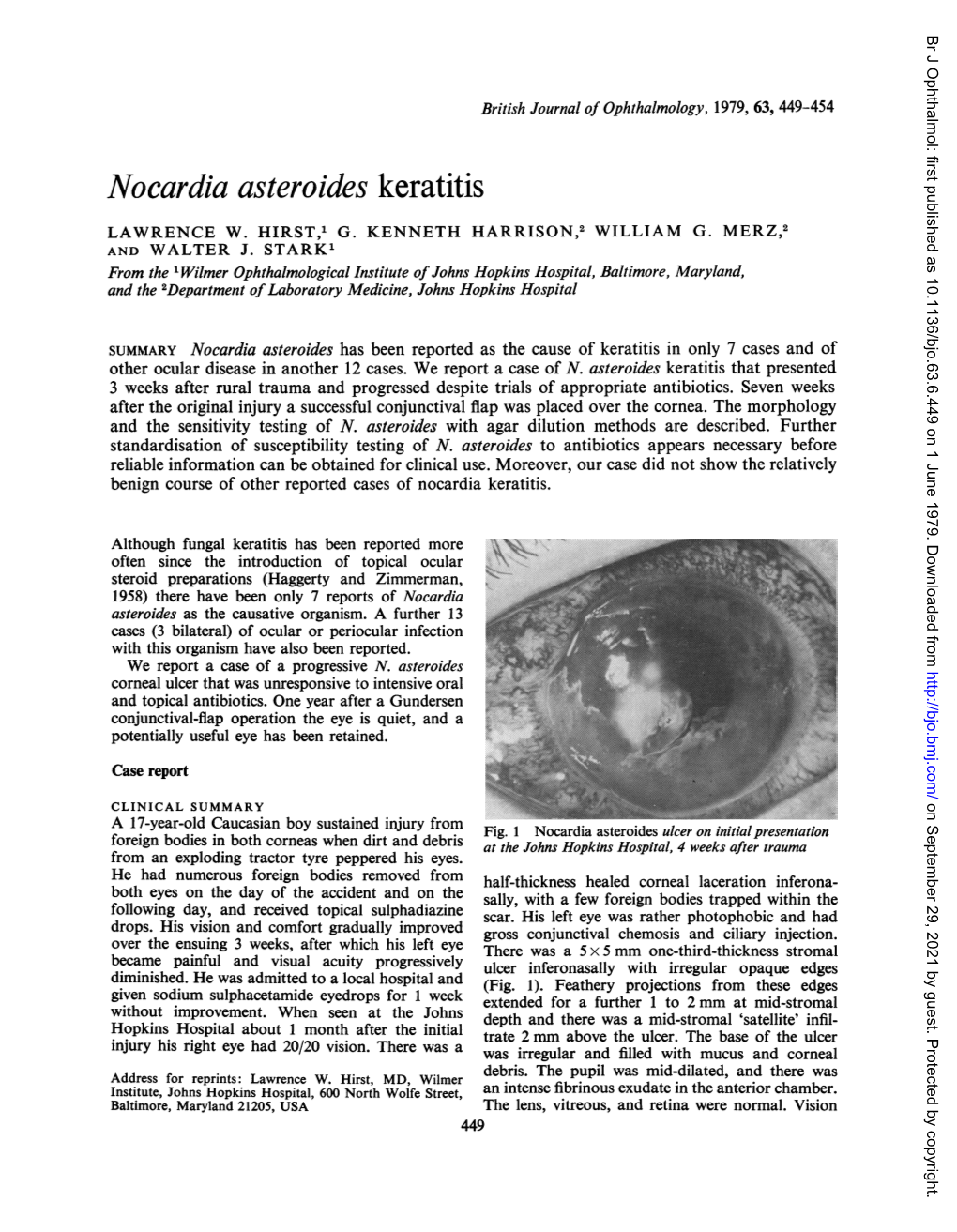 Nocardia Asteroides Keratitis