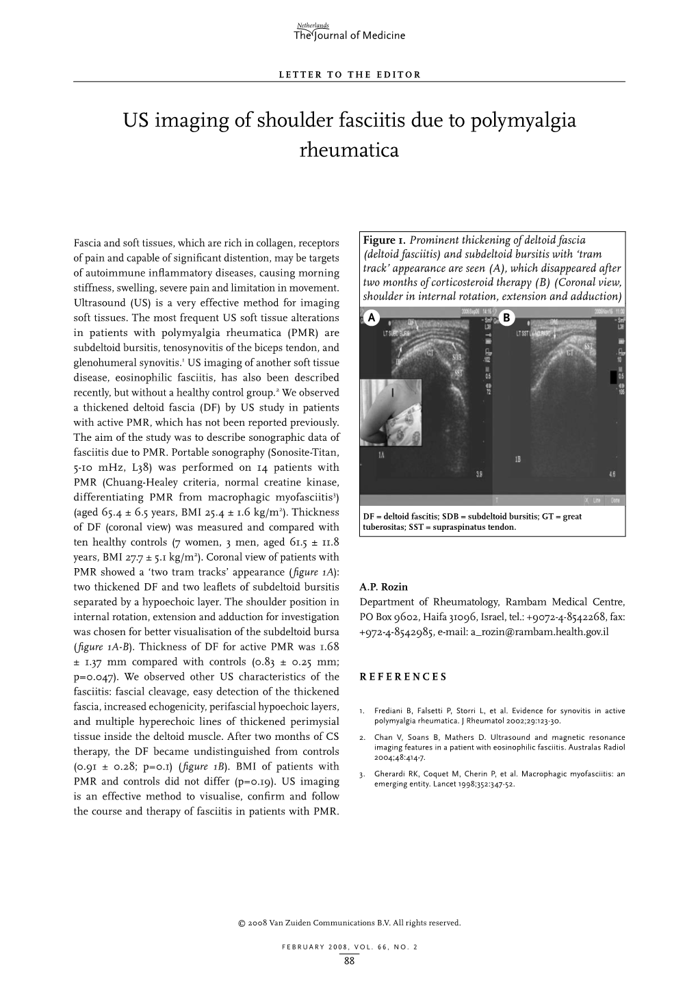 US Imaging of Shoulder Fasciitis Due to Polymyalgia Rheumatica