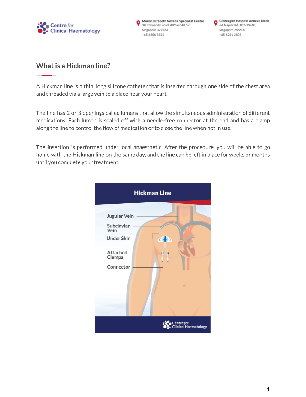 What Is a Hickman Line?