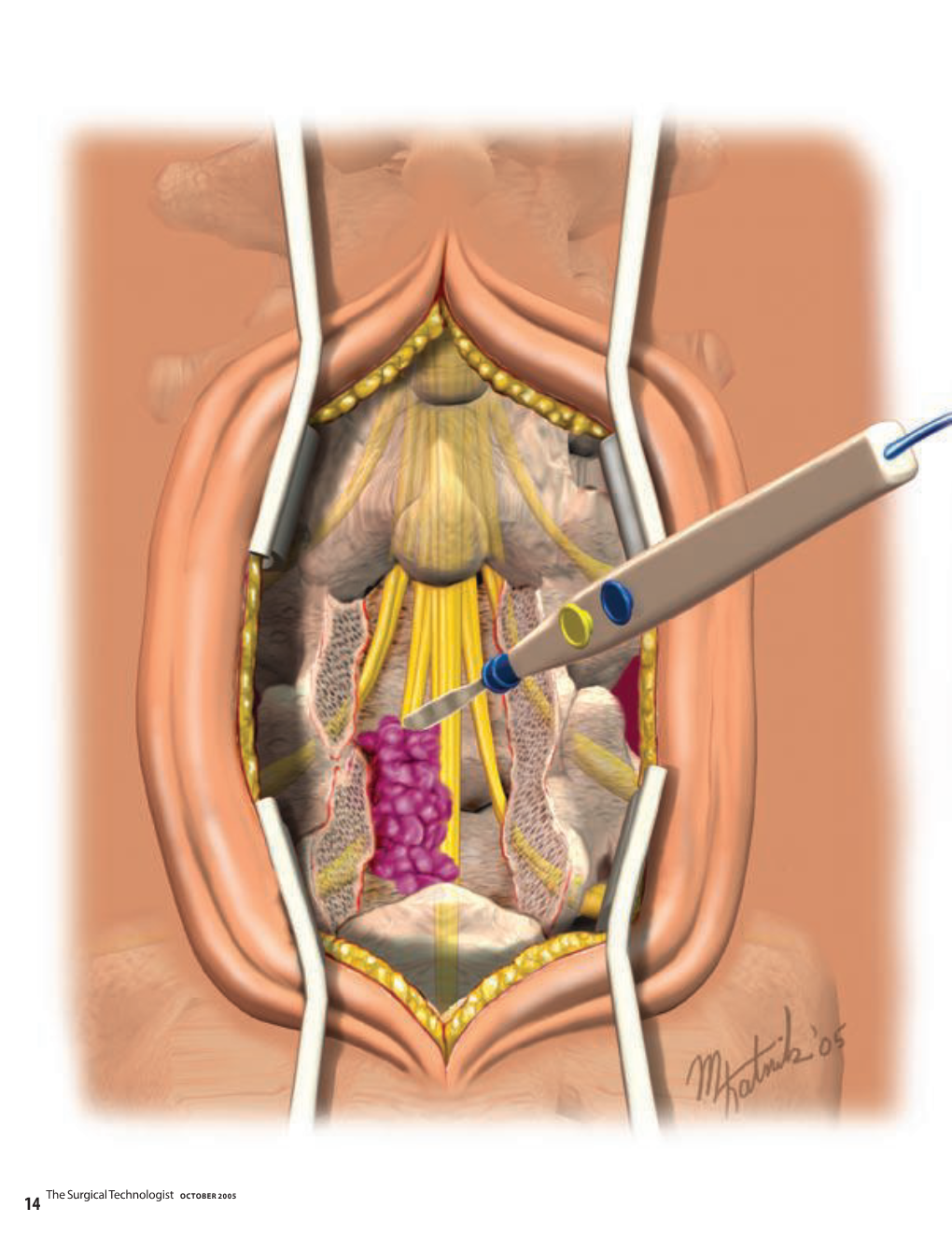 I the Surg Cal Technologist