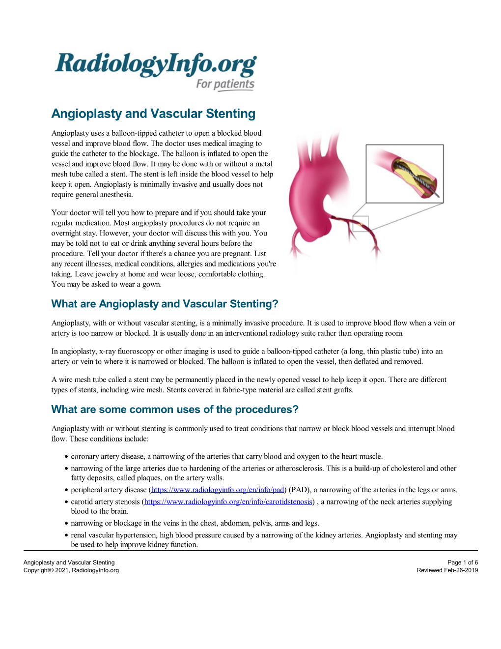 Angioplasty and Vascular Stenting Angioplasty Uses a Balloon-Tipped Catheter to Open a Blocked Blood Vessel and Improve Blood Flow