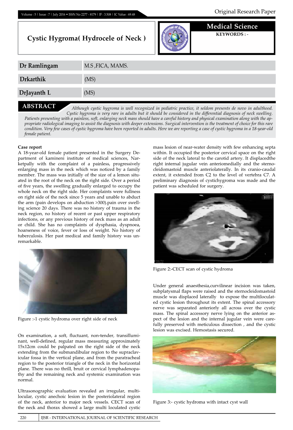 Medical Science Cystic Hygroma( Hydrocele of Neck )