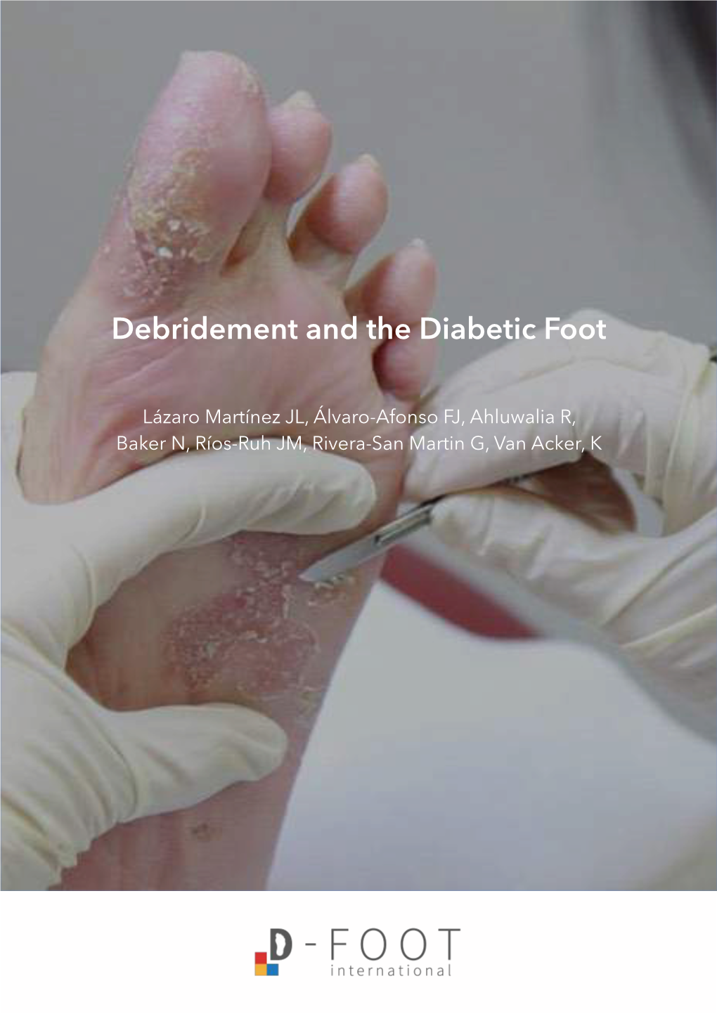 Debridement and the Diabetic Foot