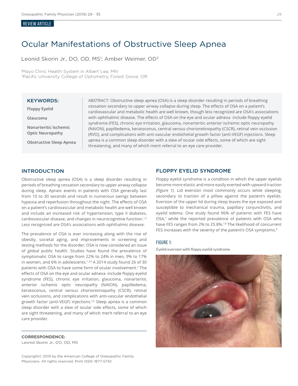 Ocular Manifestations of Obstructive Sleep Apnea Patients with Cirrhosis