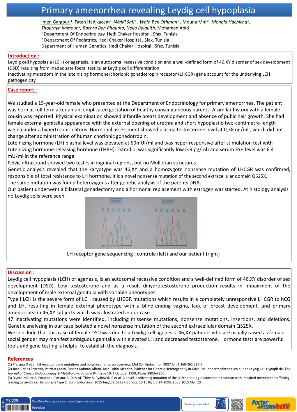 Leydig Cell Hypoplasia (LCH) Or Agenesis, Is an Autosomal