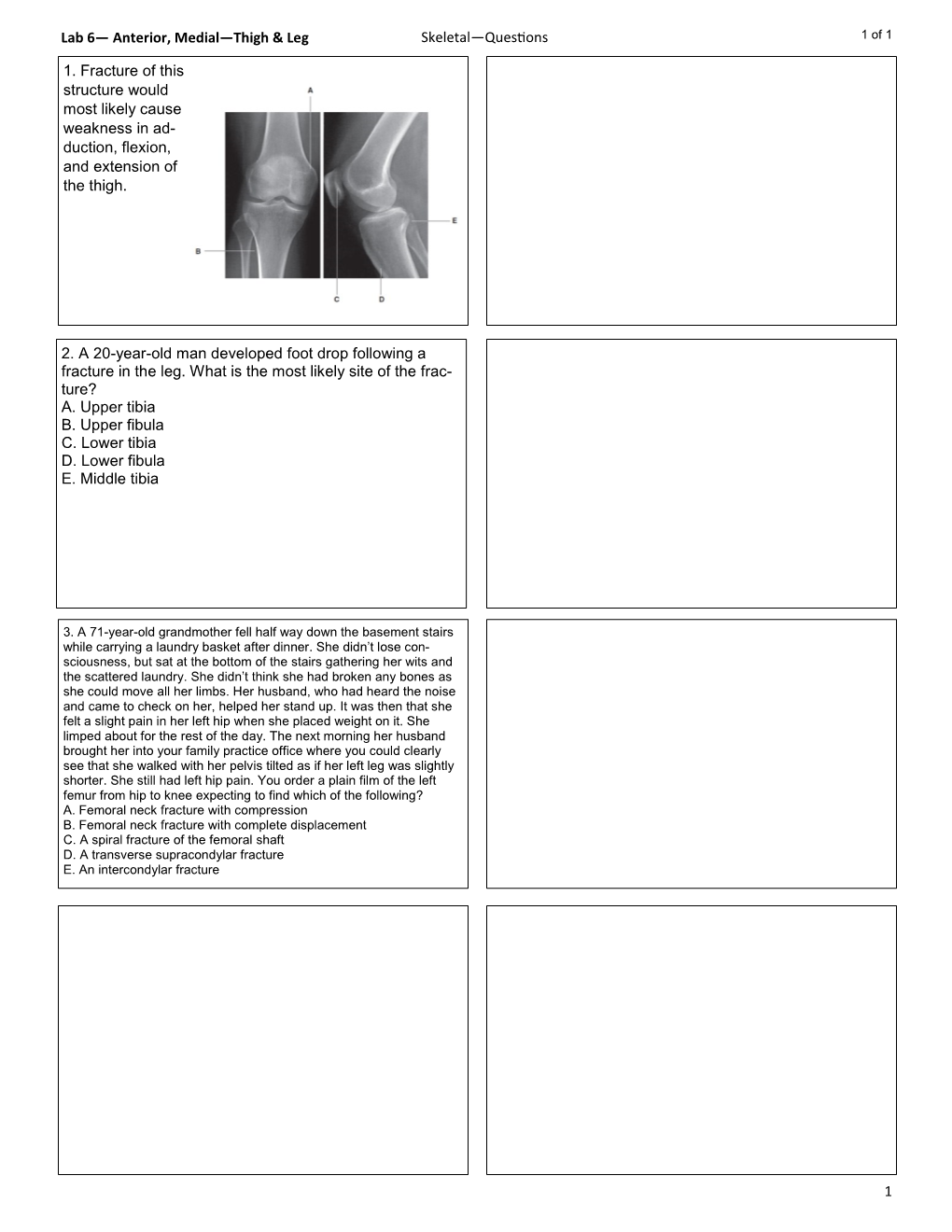 Lab 6— Anterior, Medial—Thigh & Leg 1 1. Fracture of This Structure