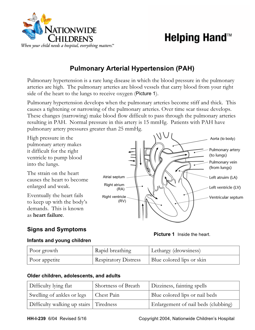 Pulmonary Arterial Hypertension (PAH)