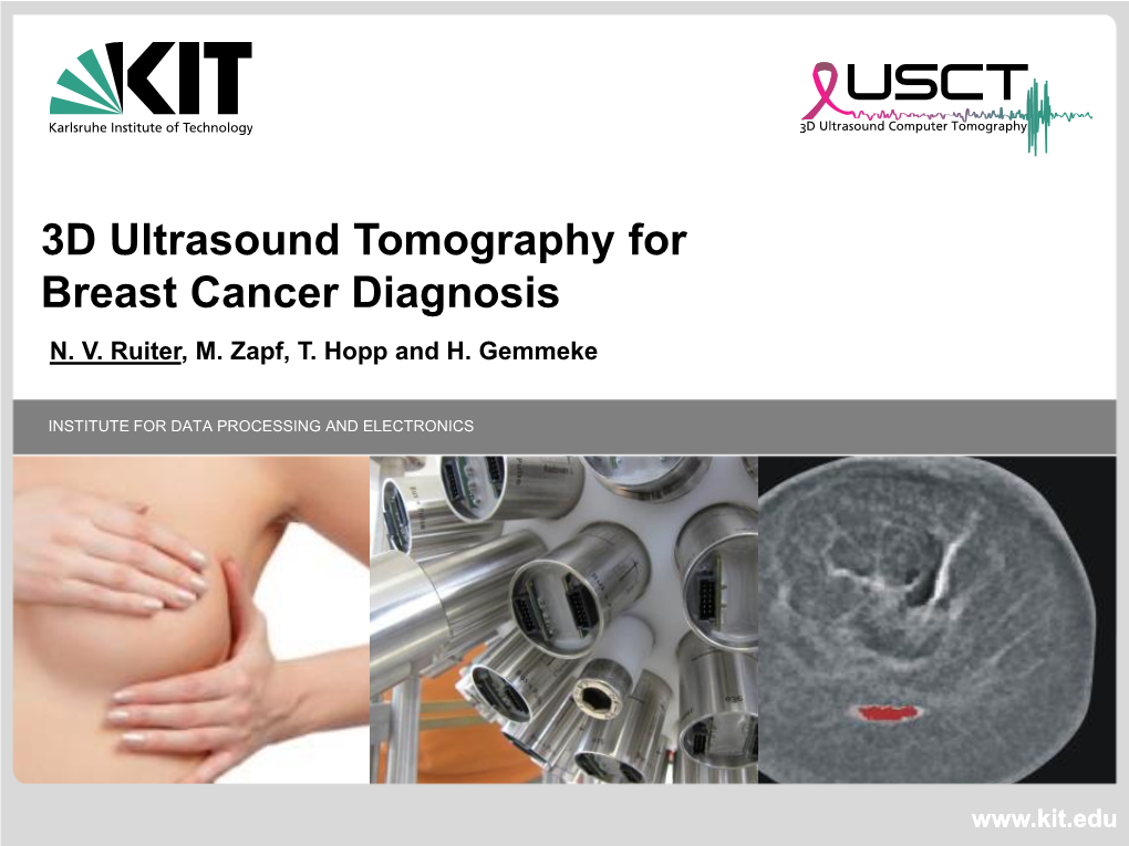 3D Ultrasound Tomography for Breast Cancer Diagnosis N