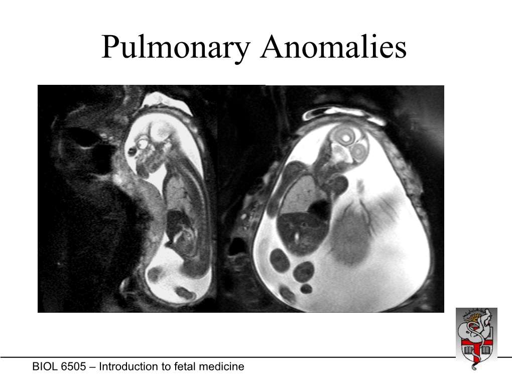 Pulmonary Anomalies