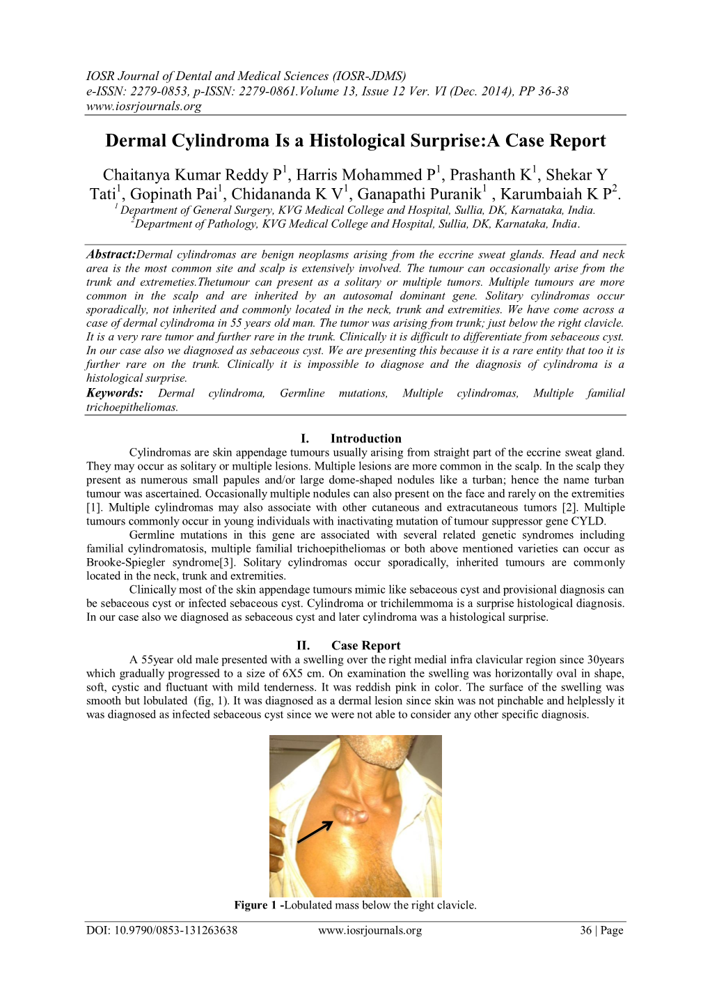 Dermal Cylindroma Is a Histological Surprise:A Case Report