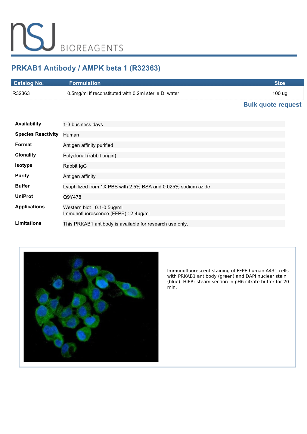 PRKAB1 Antibody / AMPK Beta 1 (R32363)