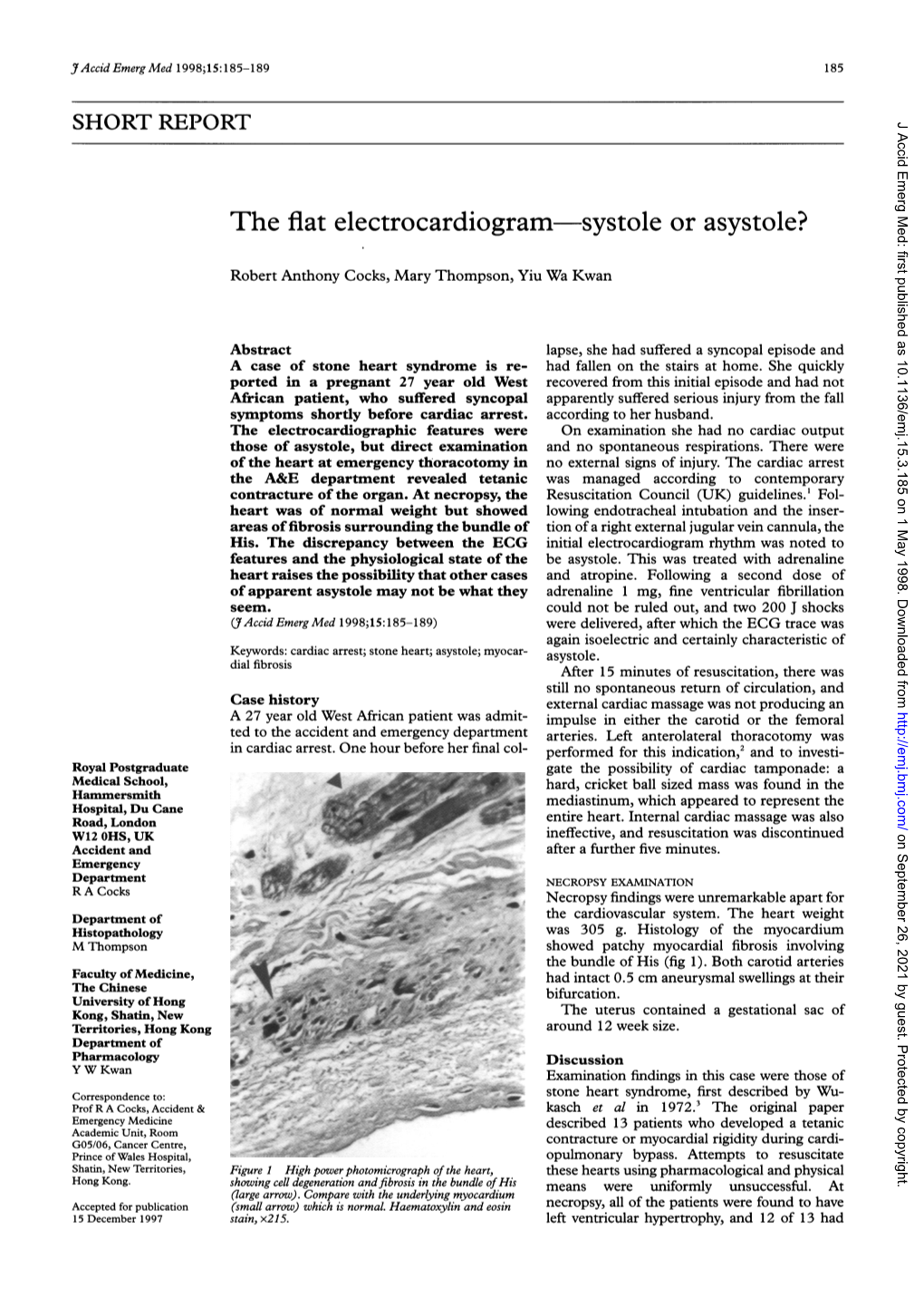 The Flat Electrocardiogram Systole Or Asystole?