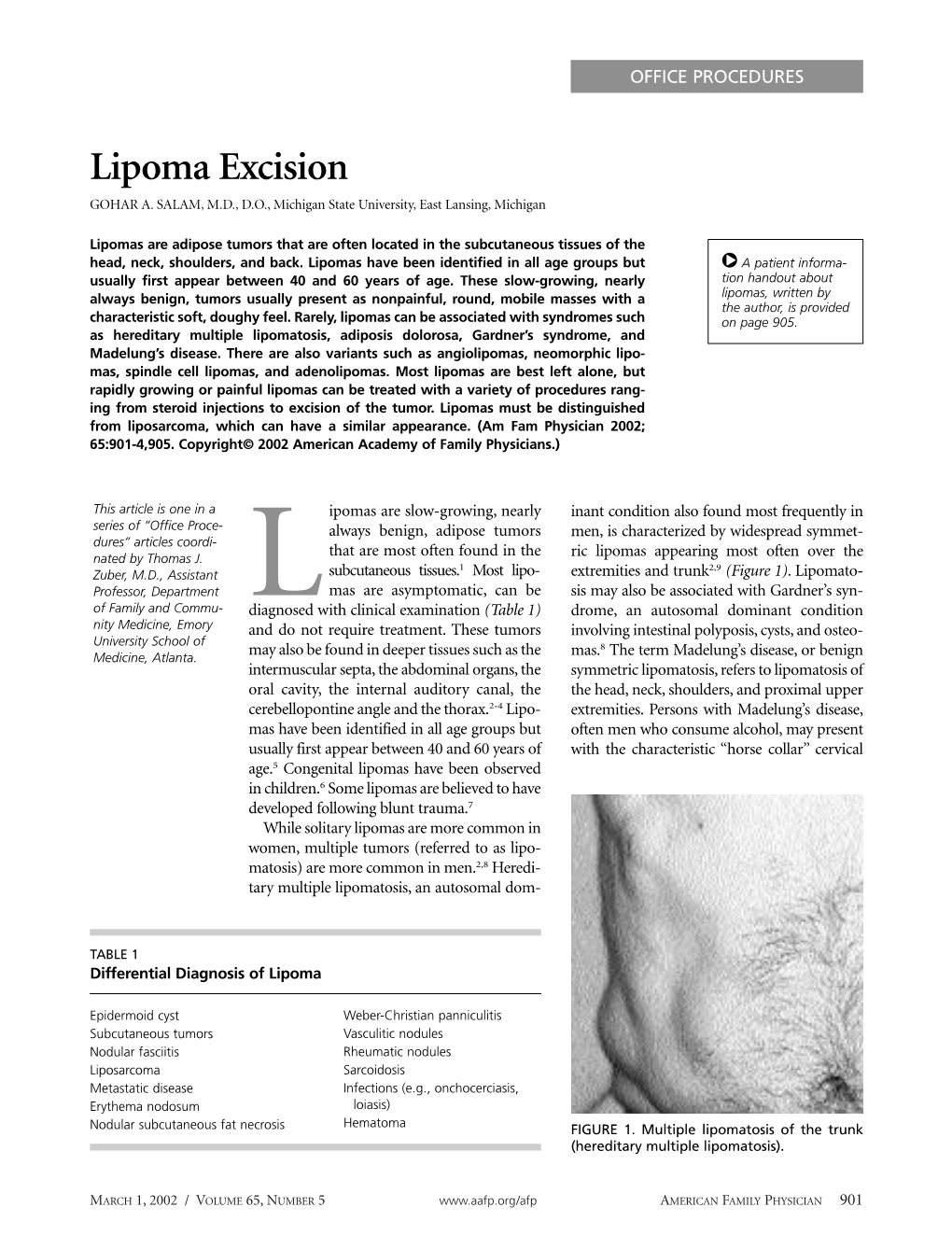 Lipoma Excision GOHAR A