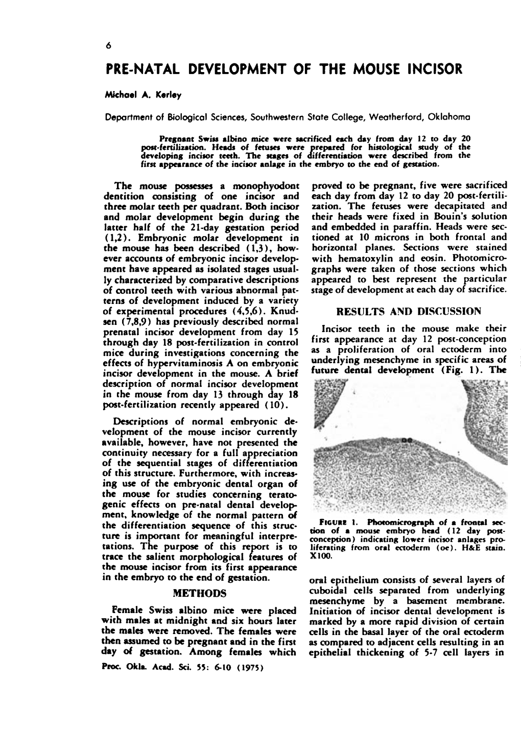 Pre-Natal Development of the Mouse Incisor