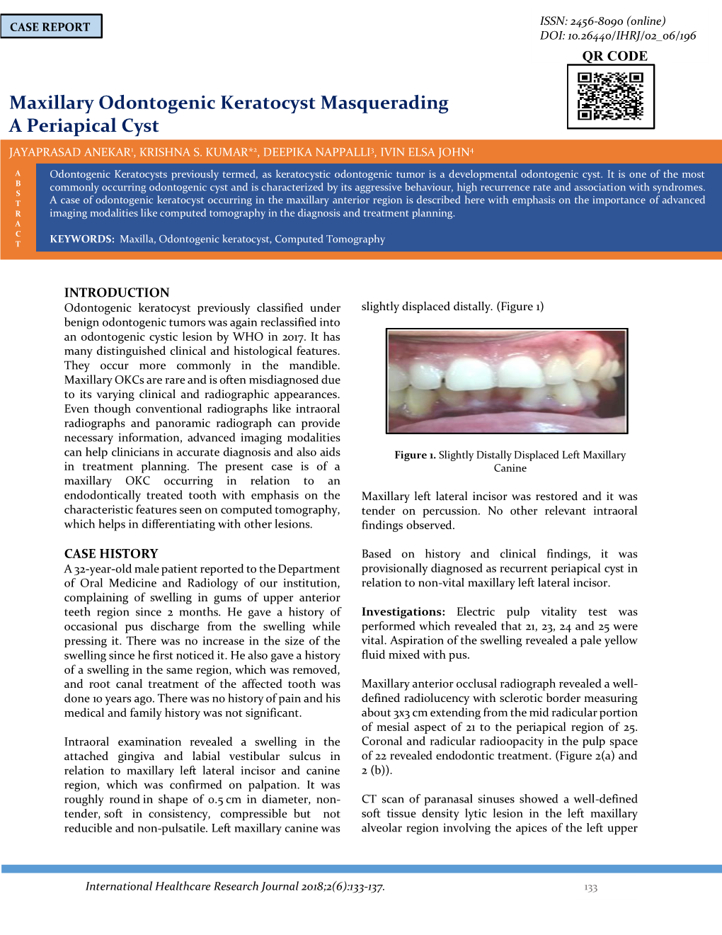 Maxillary Odontogenic Keratocyst Masquerading a Periapical Cyst