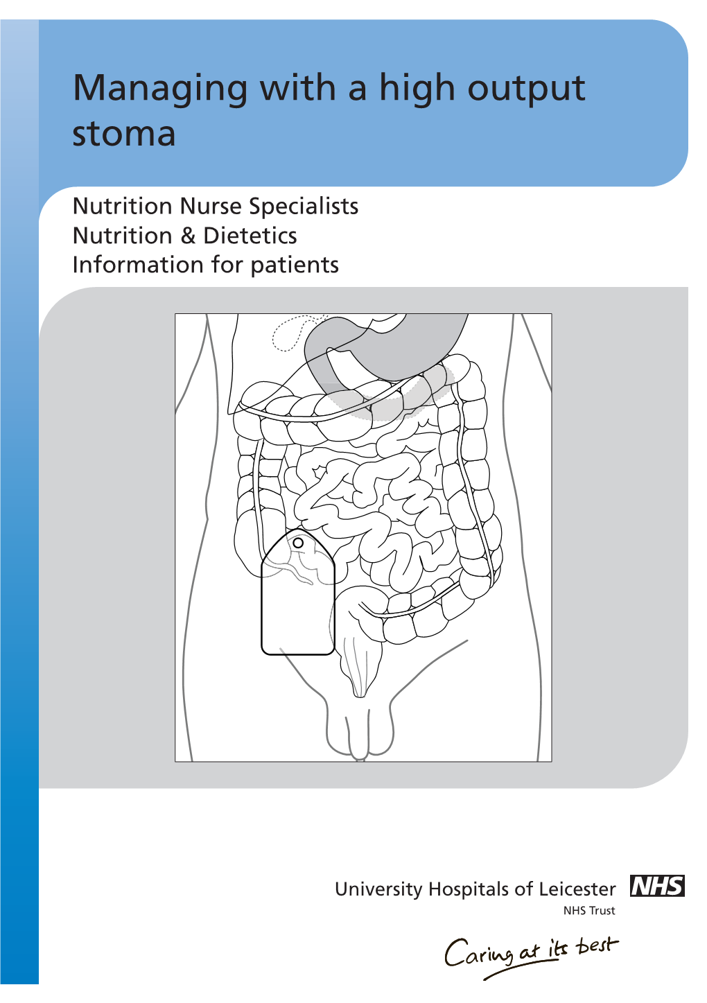 Managing with a High Output Stoma