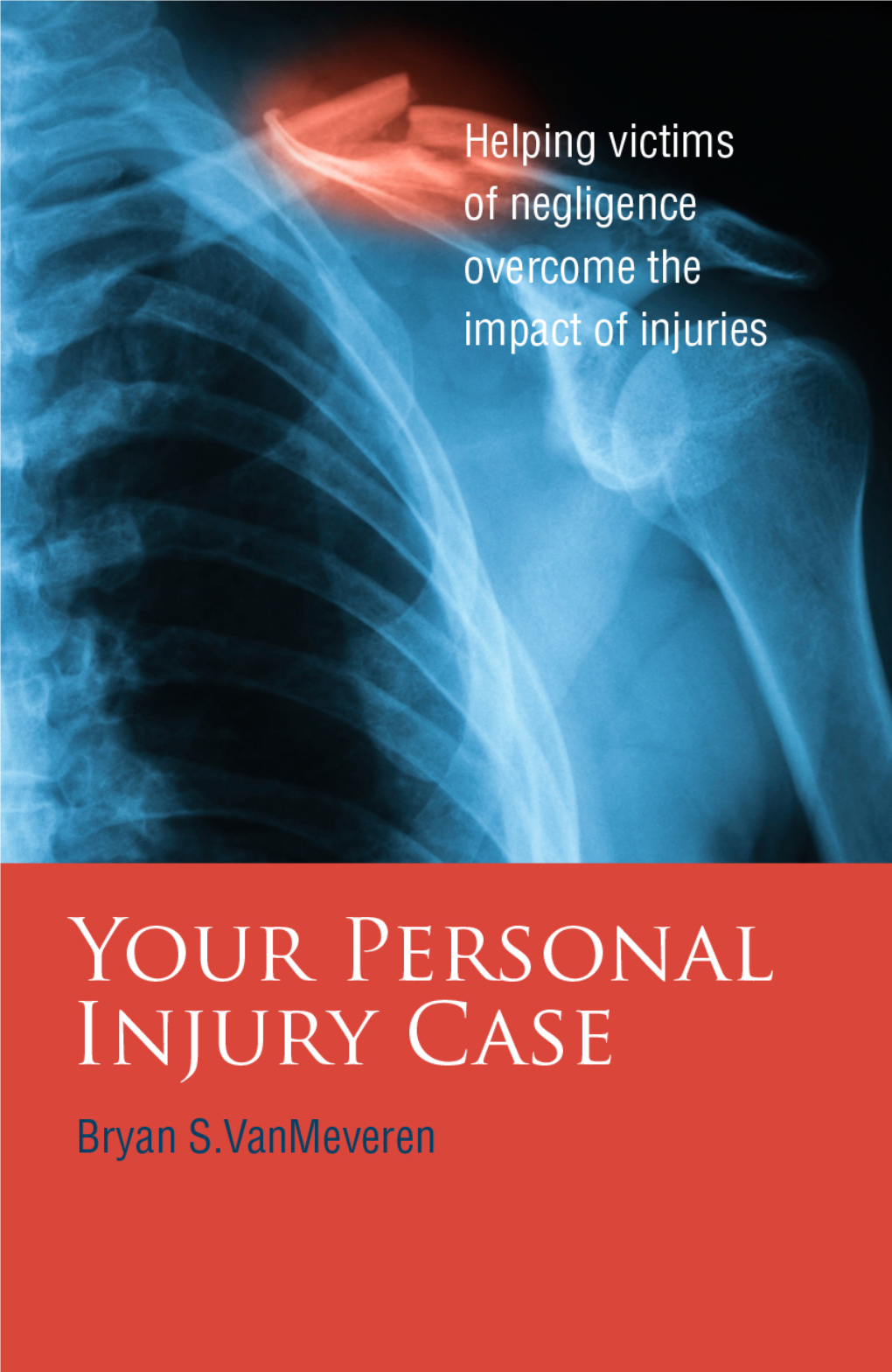 YOUR-PERSONAL-INJURY-CASE.Pdf
