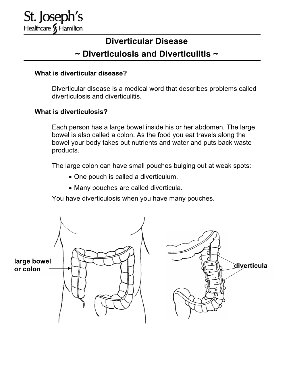 Diverticular Disease ~ Diverticulosis and Diverticulitis ~
