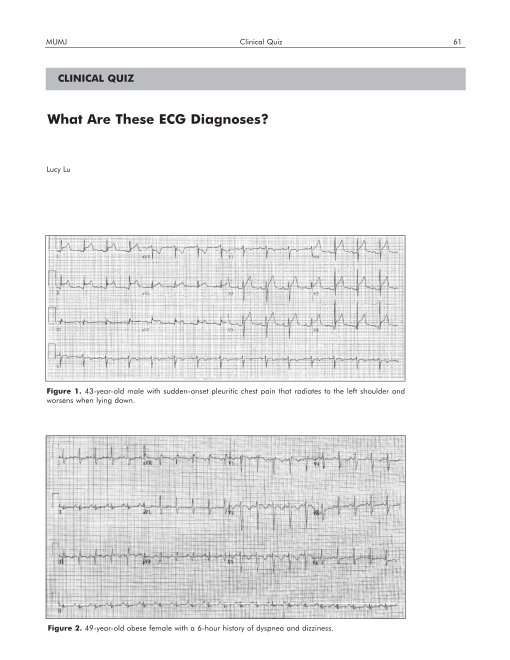 What Are These ECG Diagnoses?