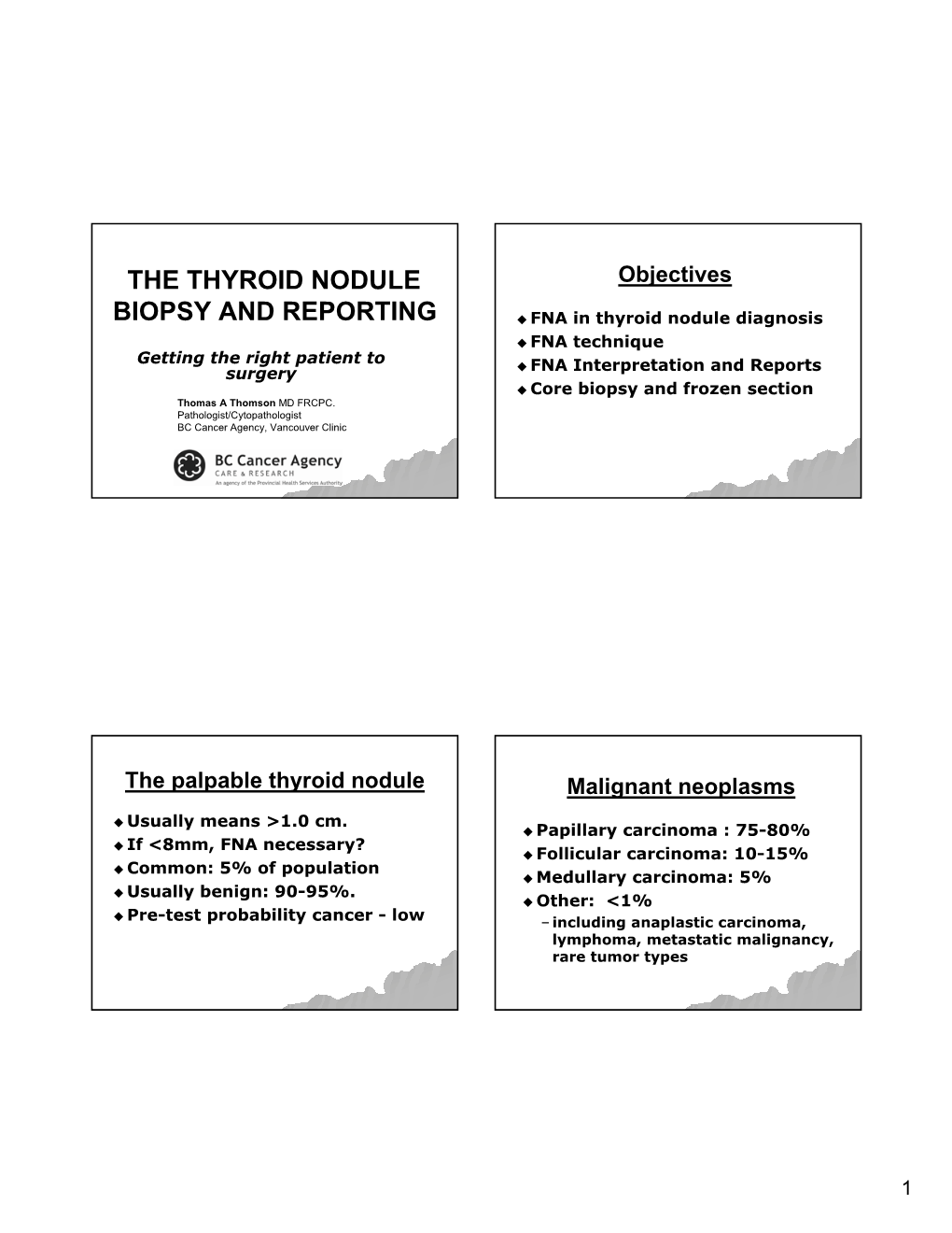 The Thyroid Nodule Biopsy and Reporting