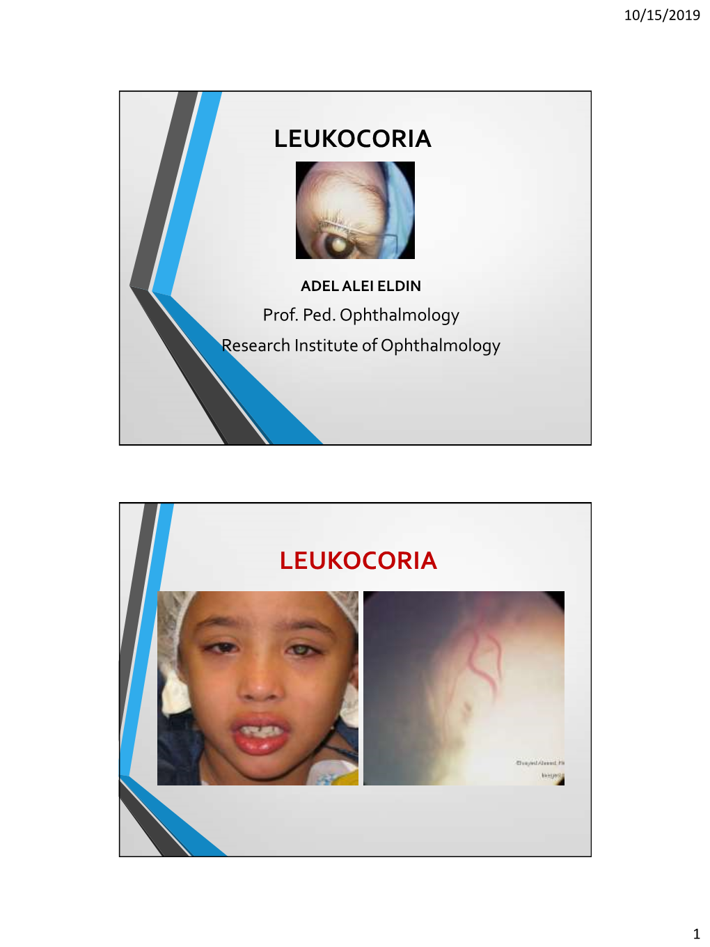 Misleading Leukocoria