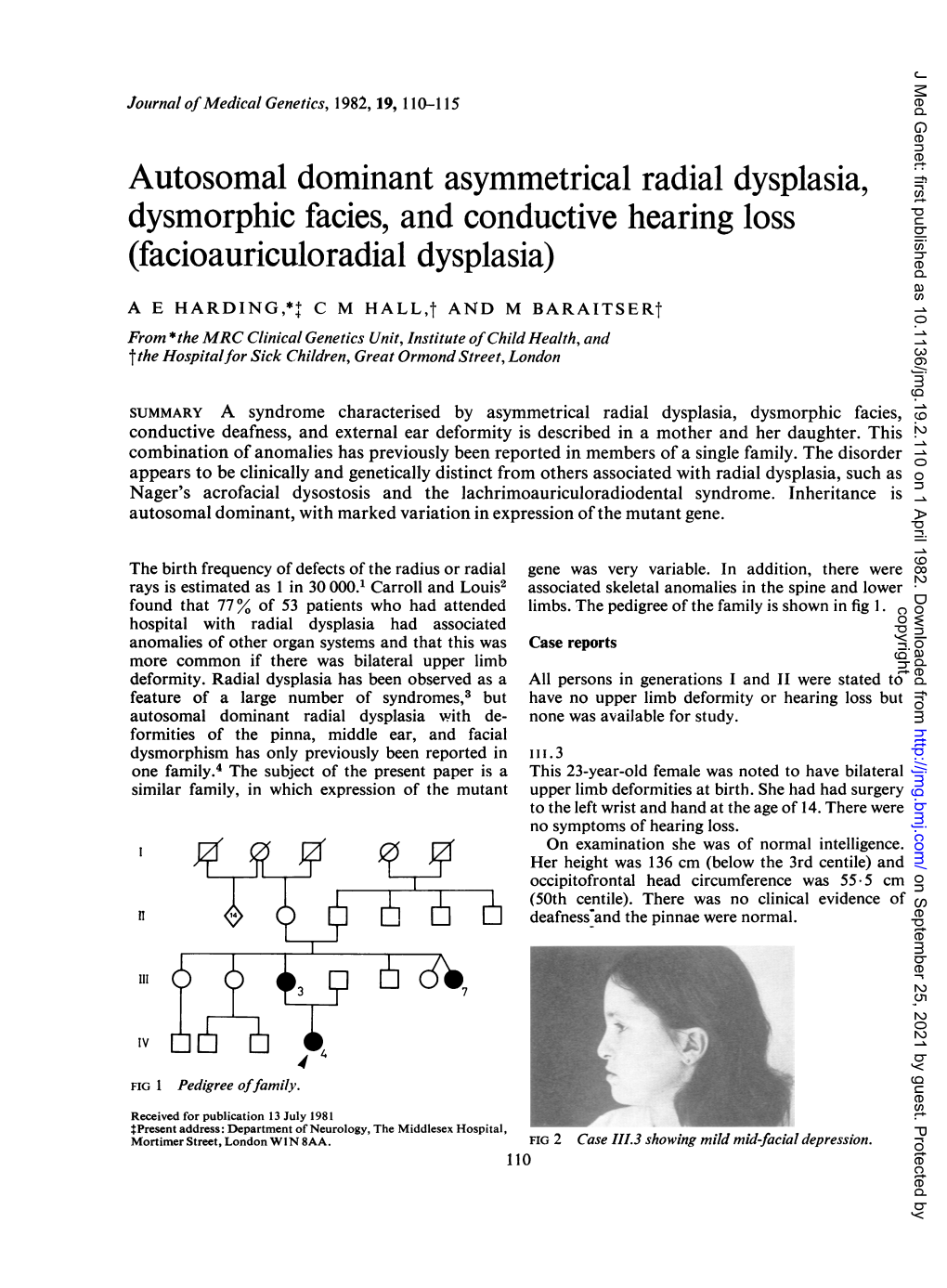 Autosomal Dominant Asymmetrical Radial Dysplasia, Dysmorphic Facies, and Conductive Hearing Loss (Facioauriculoradial Dysplasia)