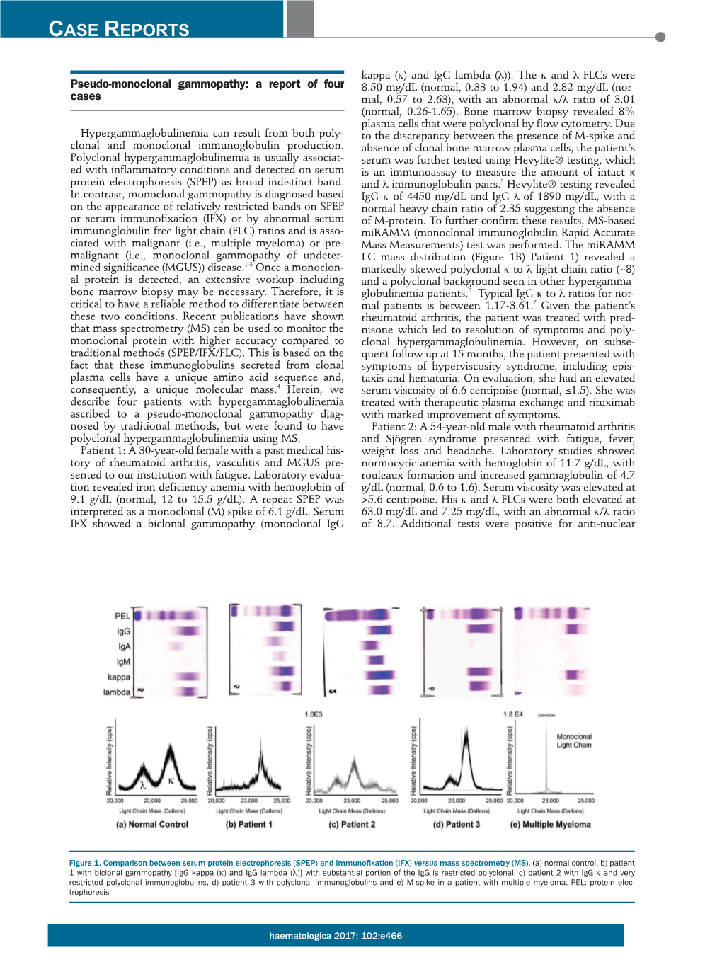 Pseudo-Monoclonal Gammopathy