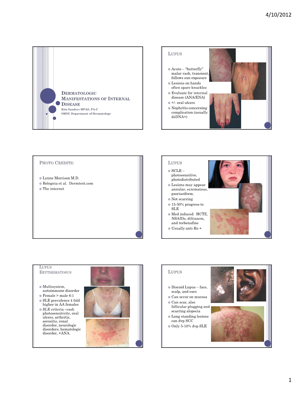 Dermatologic Manifestations of Internal Disease Photo