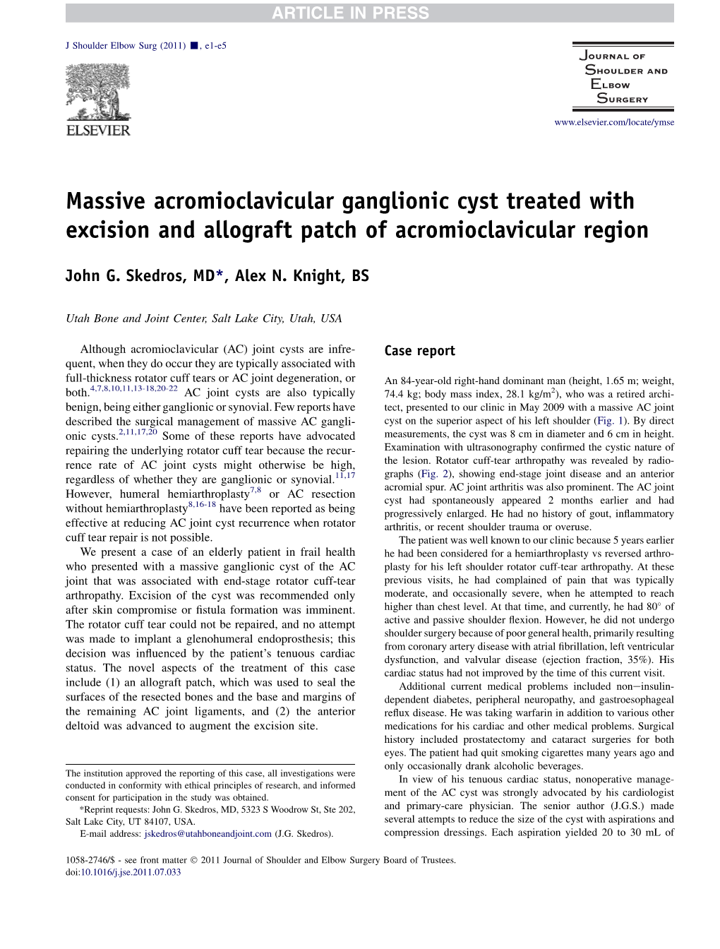 Massive Acromioclavicular Ganglionic Cyst Treated with Excision and Allograft Patch of Acromioclavicular Region