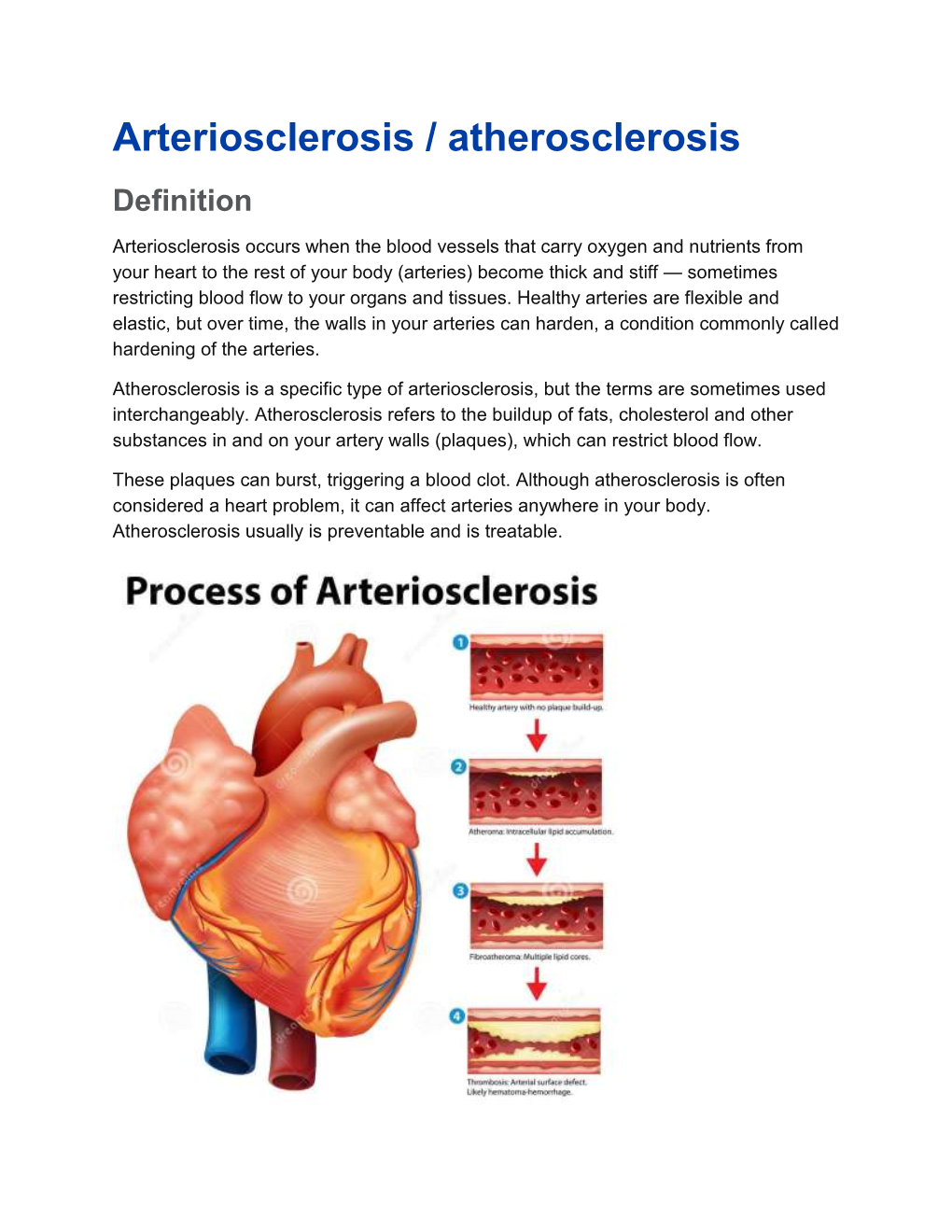 Arteriosclerosis / Atherosclerosis Definition