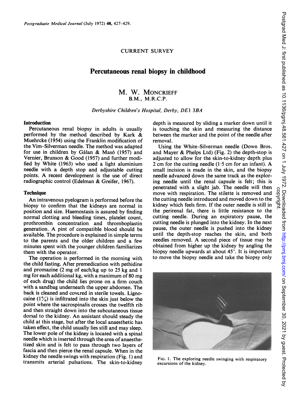 Percutaneous Renal Biopsy in Childhood M. W. MONCRIEFF