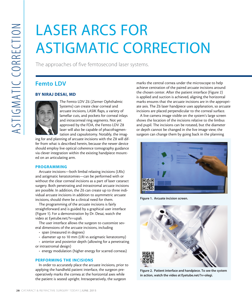 LASER ARCS for ASTIGMATIC CORRECTION the Approaches of Five Femtosecond Laser Systems