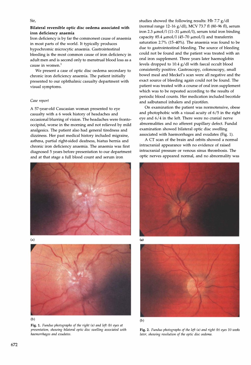 672 Sir, Iron Deficiency Is by Far the Commonest Cause of Anaemia In