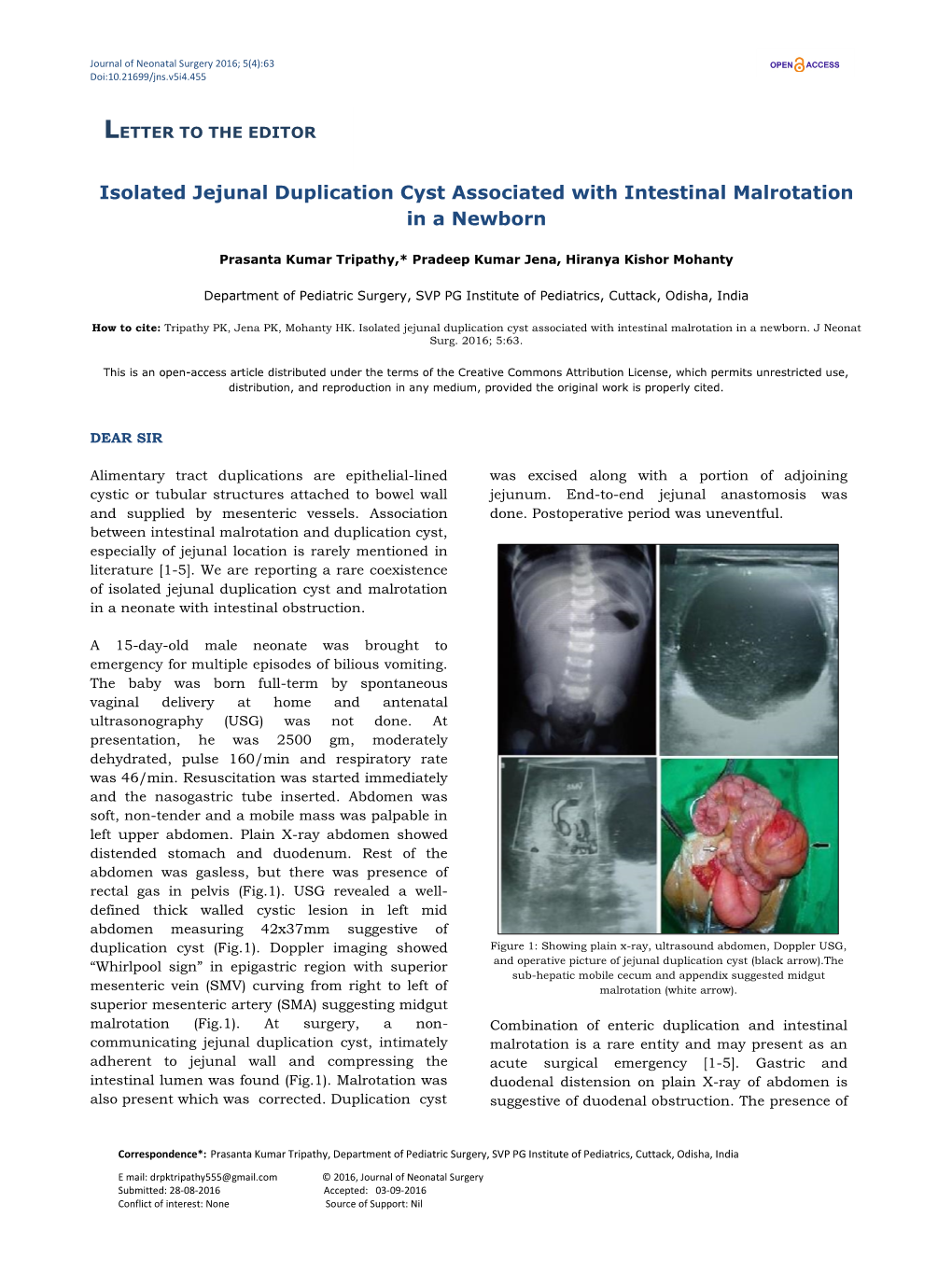 Isolated Jejunal Duplication Cyst Associated with Intestinal Malrotation in a Newborn