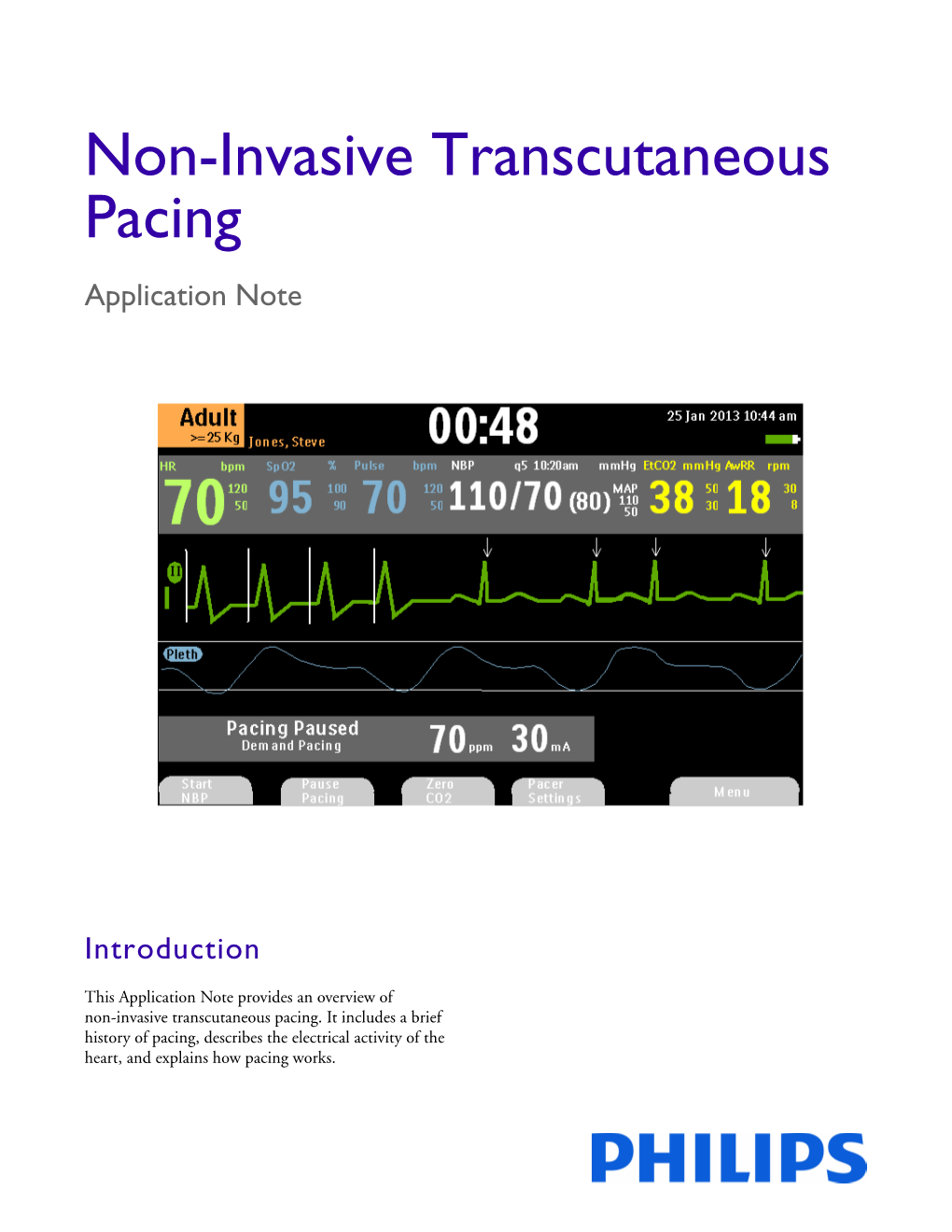 Non-Invasive Transcutaneous Pacing Application Note